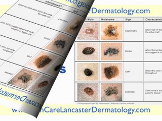 Dermatologist in Lancaster PA - Dermatologists Lancaster PA