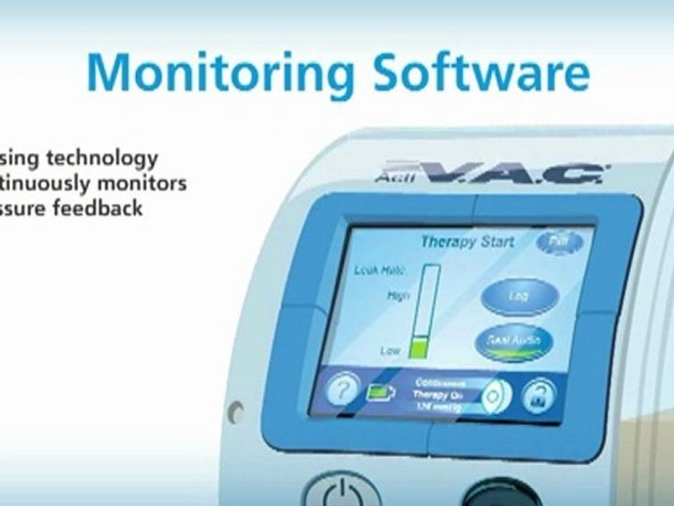 Negative Pressure Wound Therapy (NPWT) System | SensaT.R.A.C. | KCI
