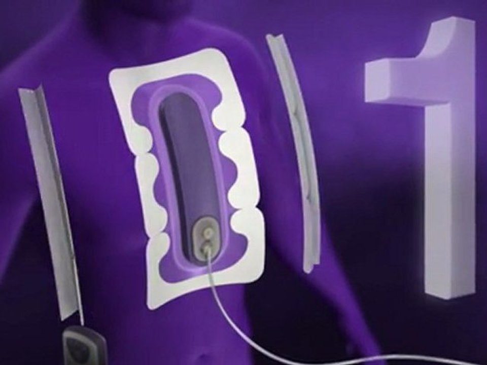 Incision Management System Prevena KCI video Dailymotion