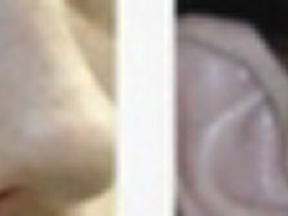 acne scars treatments NYC