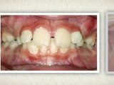 Finding A Great Orthodontist Westminster