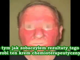 Konopia Leczy Panaceum na nowotwór złośliwy napisy PL THC Marihuana - S24h7