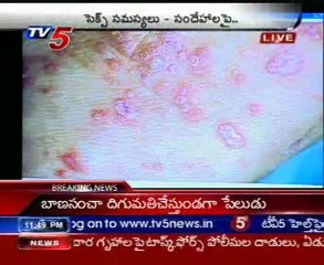 Sparsha - The Touch - Sex Problems & Advises by Dr. Kammela Sridhar - 02