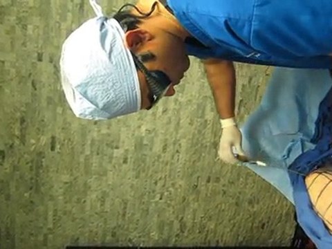 SmartLipo Laser Liposuction-Valley Aesthetics and Laser-626-961-7700