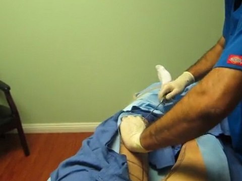 Laser Liposuction-SmartLipo-Valley Aesthetics and Laser-Hacienda Heights-626-961-7700