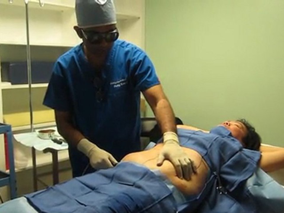 SmartLipo Laser Liposuction-Valley Aesthetics and Laser-Hacienda Heights-626-961-7700