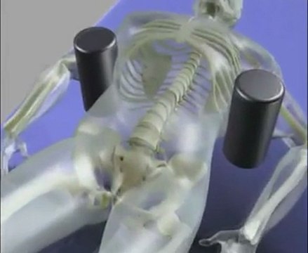 Back Pain Treatment | Non-surgical Spinal Decompression | Disc Herniation Treatment