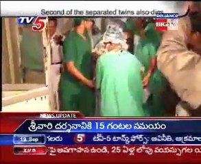 Second of the separated twins also dies