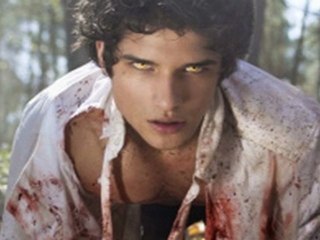 Teen Wolf season 1 episode 4 Magic Bullet