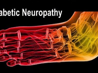 Diabetic Foot Care – Fleming Island and Palm Coast, FL Pod