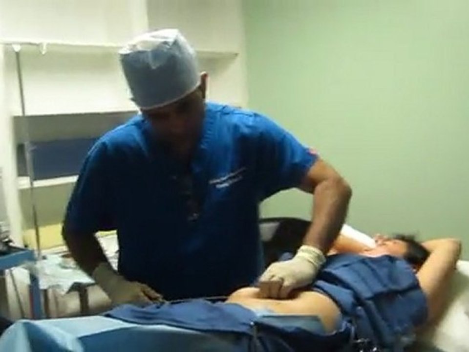 SmartLipo Laser Liposuction-Valley Aesthetics and Laser-626-961-7700