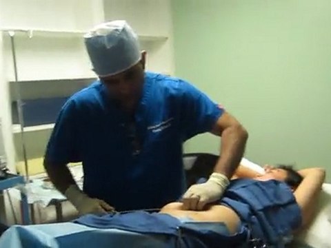 SmartLipo Laser Liposuction-Valley Aesthetics and Laser-626-961-7700