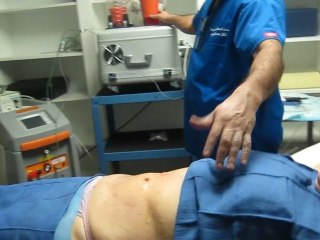 SmartLipo Laser Liposuction-valley Aesthetics and Laser-626-961-7700