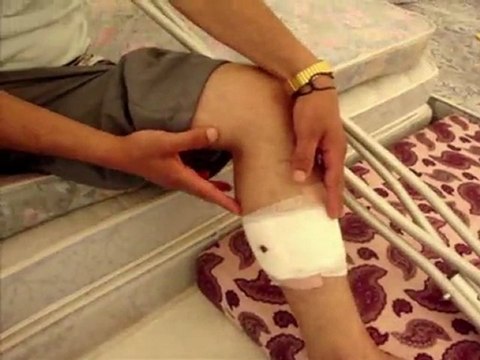 Arabic-web-Turkey copes with Syrian refugees