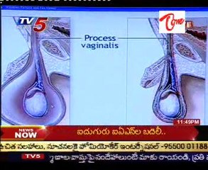 Sparsha - The Touch - Sex Problems & Advises by Dr. Kammela Sridhar - 03