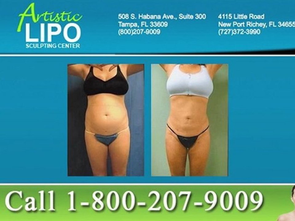 Tampa Lipo and Body Contouring