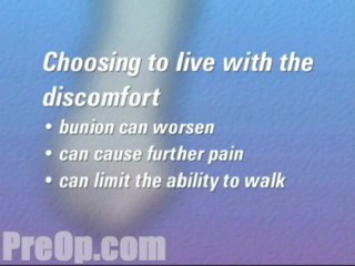 Bunion Removal Foot Surgery  - Alternatives