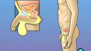 Cystoscopy Male  - Alternatives