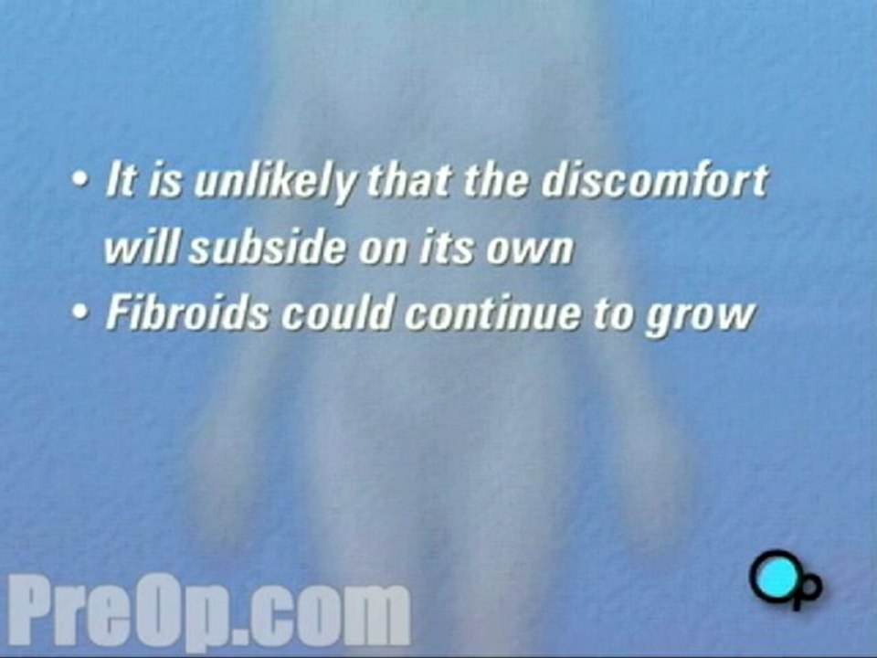 Myomectomy Abdominal Fibroid Removal  - Alternatives