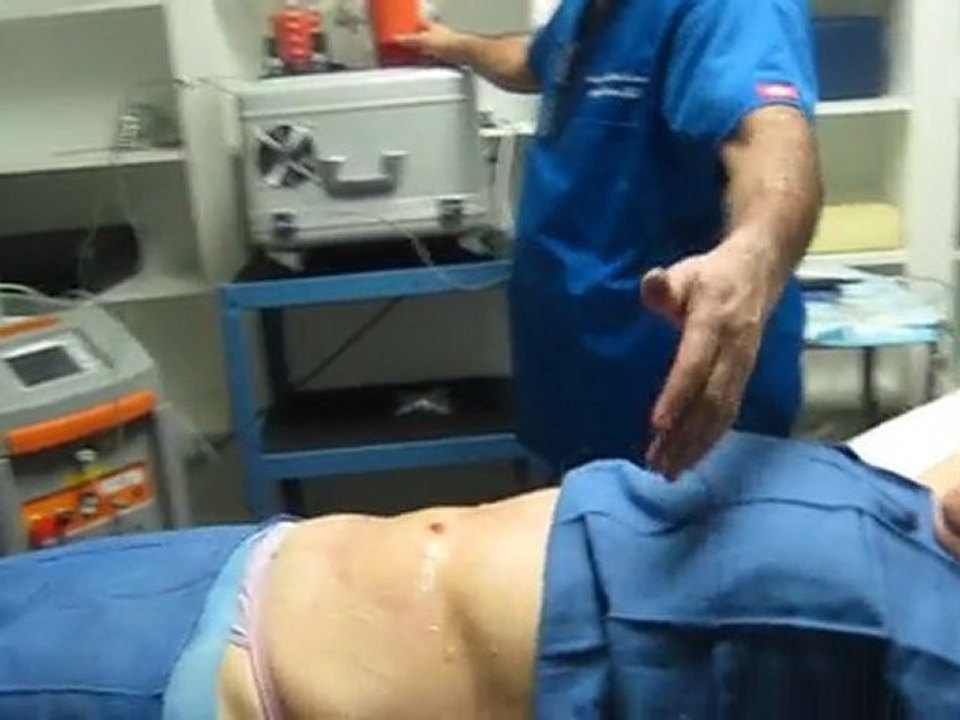 Laser Liposuction-Los Angeles County-Orange County-Riverside County-San Bernardino County-Inland Empire-Anaheim-Fullerton-Rancho Cucamonga-Irvine-Orange-Cerritos-Whittier-Covina-Hacienda Heights-Rowland Heights