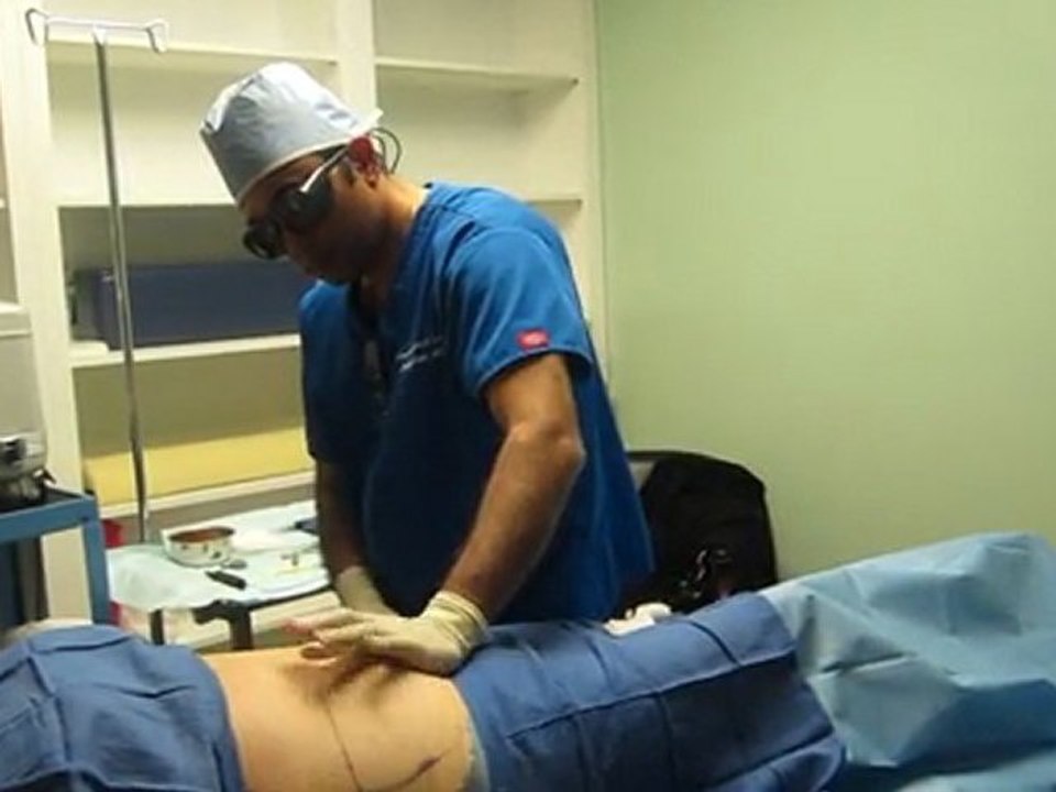 Laser Liposuction-Los Angeles County-Orange County-Riverside County-San Bernardino County-Inland Empire-Anaheim-Fullerton-Rancho Cucamonga-Irvine-Orange-Cerritos-Whittier-Covina-Hacienda Heights-Rowland Heights