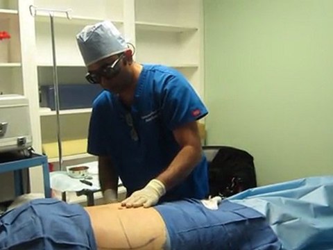 Laser Liposuction-Los Angeles County-Orange County-Riverside County-San Bernardino County-Inland Empire-Anaheim-Fullerton-Rancho Cucamonga-Irvine-Orange-Cerritos-Whittier-Covina-Hacienda Heights-Rowland Heights