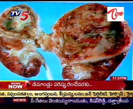 Sparsha-The Touch,SEX Problems Advises Dr. Kammela Sridhar_Part-01