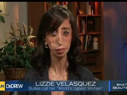 Lizzie Velasquez interview 2012