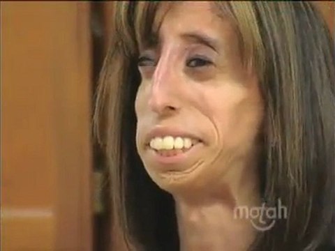 Femme la plus maigre du monde