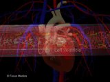 Hypertension (Animated Pocket Dictionary)