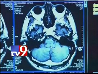 Stem Cell therapy to revolutionise health care