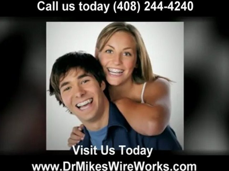 cheap braces San Jose (408) 244-4240 "cheap braces san jose"