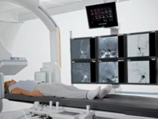 ccsvi symptoms