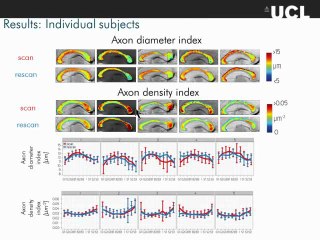 A video tutorial on the clinical feasible mapping of the axon diameter index in the corpus callosum