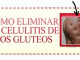 Como Eliminar la Celulitis  de los Gluteos-Como Eliminar la Celulitis Rapidamente