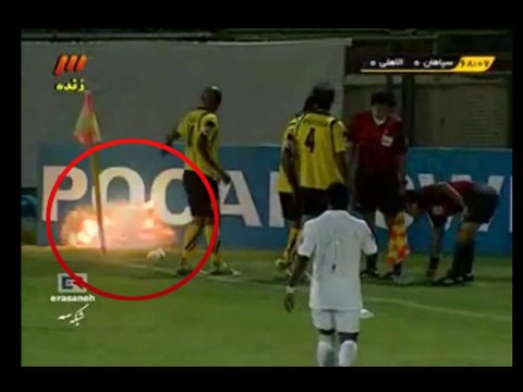 Un footballeur a failli perdre sa main sur le terrain