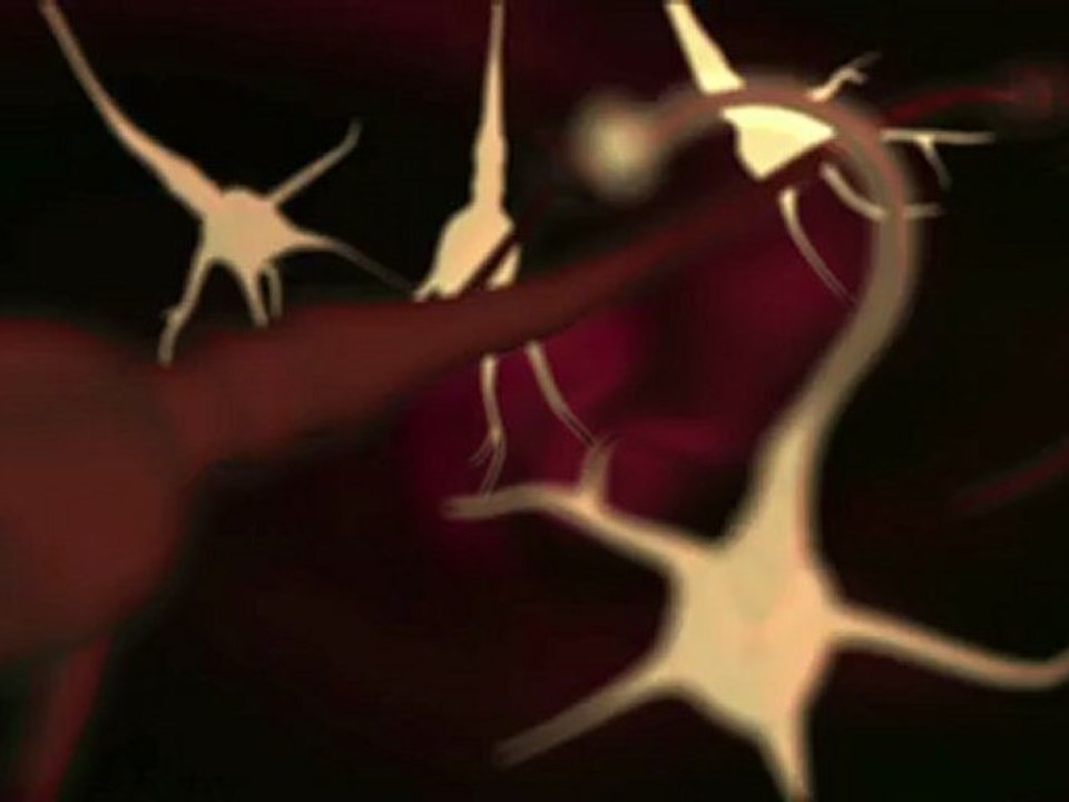 Alzheimer's disease
