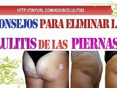 8 Consejos para Eliminar la Celulitis de las Piernas-Como Eliminar la Celulitis