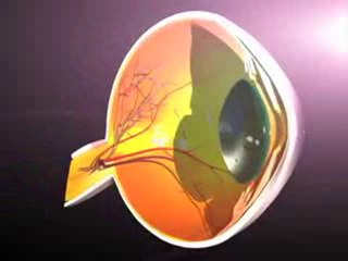 LASIK & Cataract (Understanding Disease_ Ophthalmology)