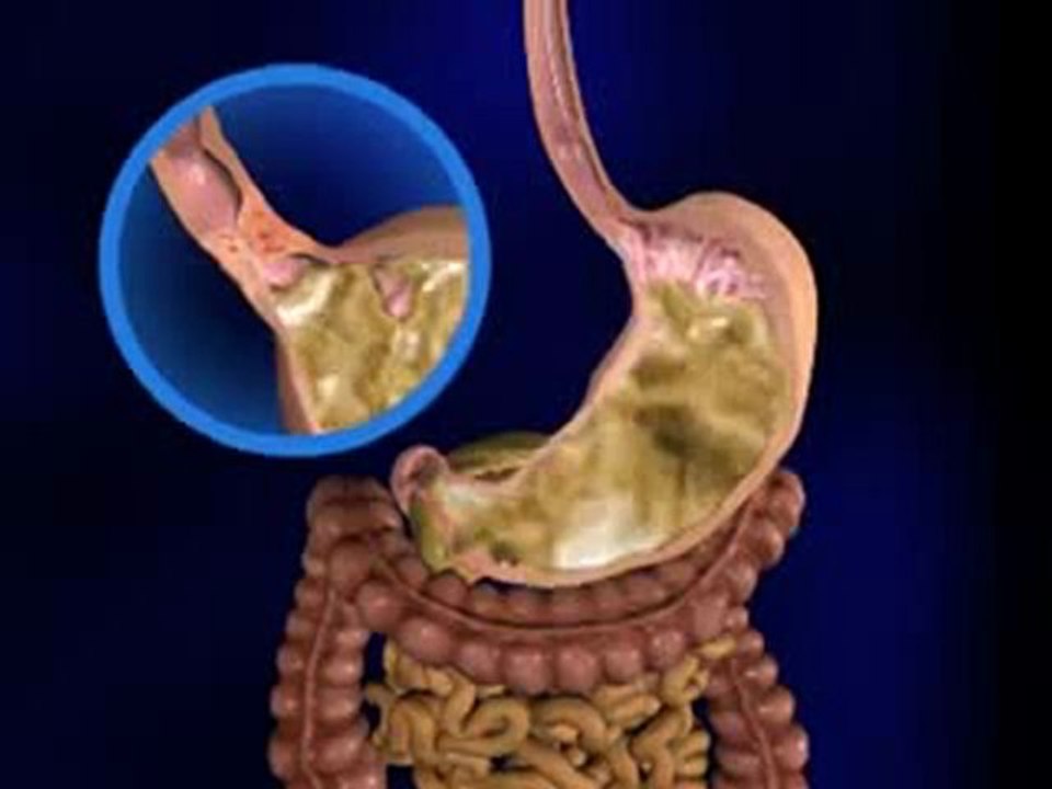 Digestion (Jr. Animated Atlas of Anatomy and Physiology_ Digestive and Excretory System)