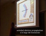 Audicion Humana - Crisis motoras y alucinaciones sensoriales - Prof Manuel Lafarga