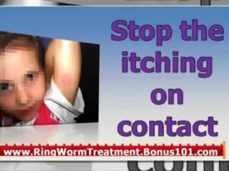 how do you get rid of ringworm - home remedies for ringworm in humans - home remedy for ringworm