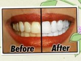 Creating a Good-looking Smile with Broomall Emergency Dentist