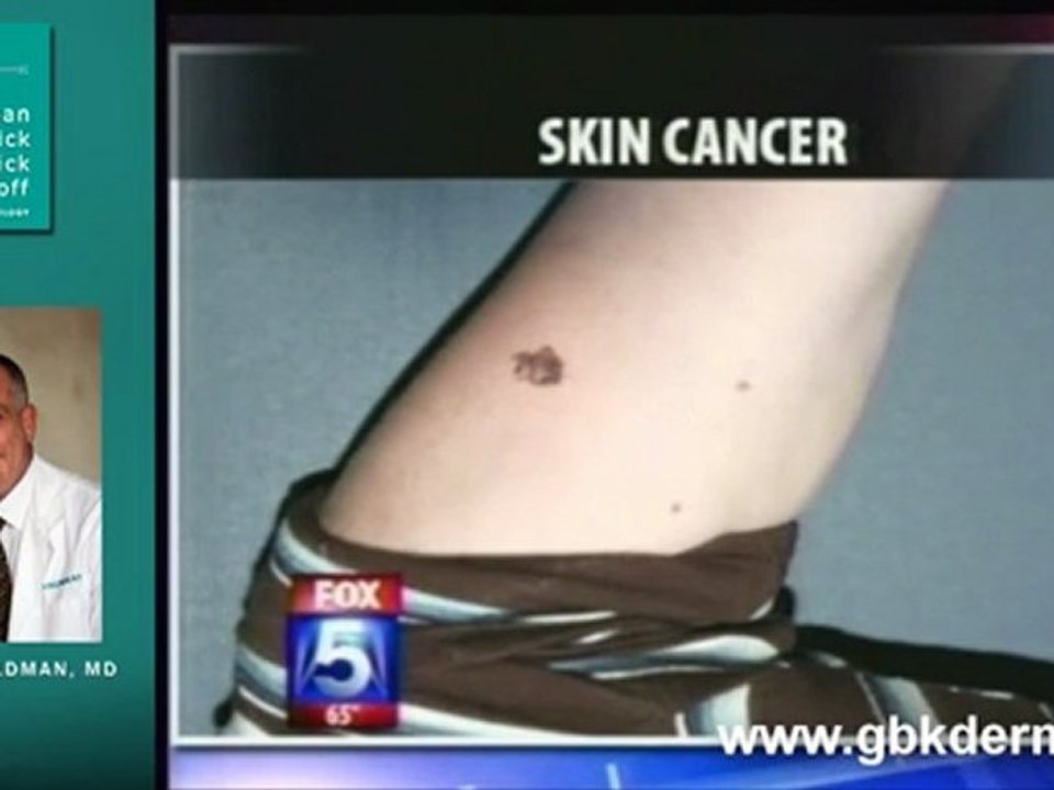 Dermatologist In San Diego On The Dangers Of Tanning