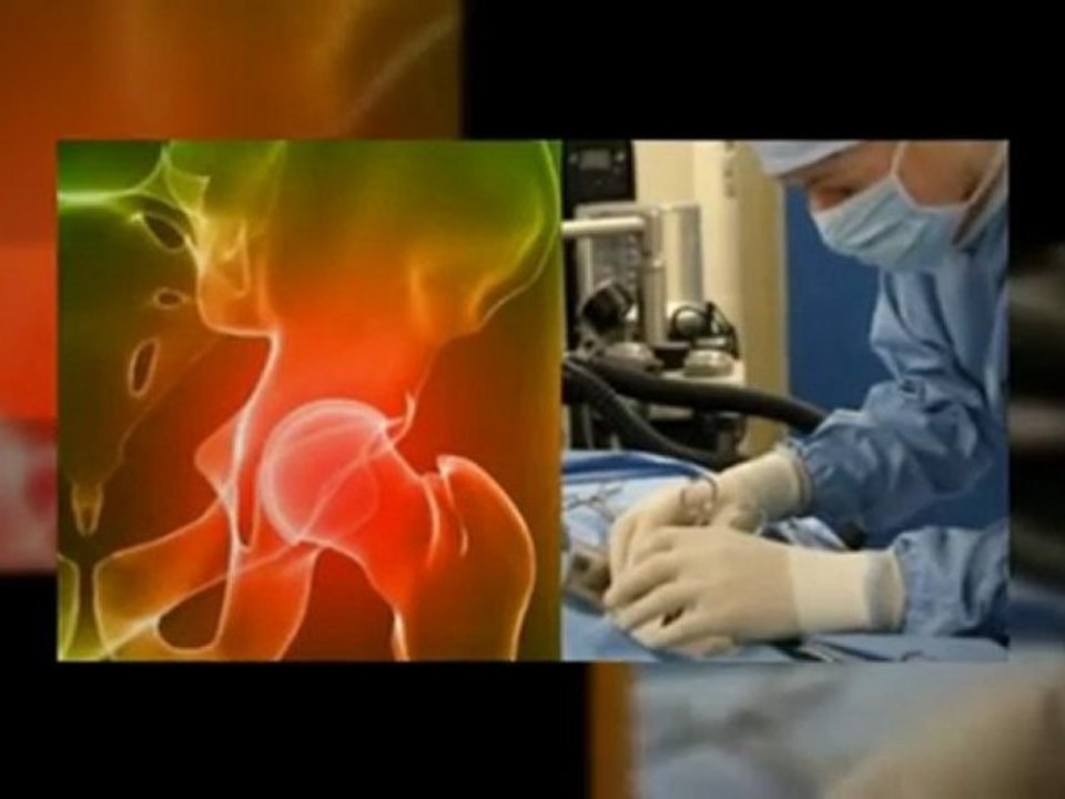 Now ASR Hip Recall Is Here