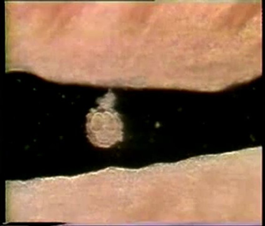 İnsanın 'alak'tan yaratılışı