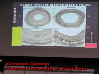 Gershon Golomb - Modulation of the innate immunitate by nanoparticles for Restenosis Therapy