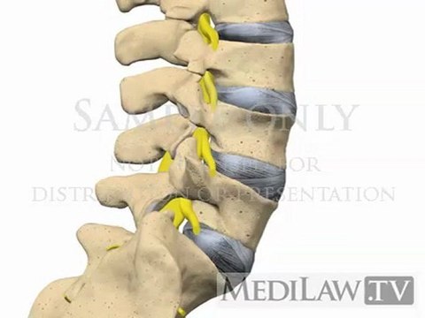 Lumbar Spine Anatomy Inter-vertebral Disc Nucleus Annulus neuro-surgery multimedia