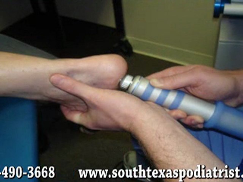 Plantar Fasciitis Treatment - Podiatrist in San Antonio, Liv