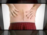 Chiropractor: Is Surgery the Way to Treat Chronic Back Pain?